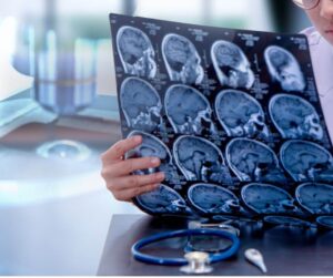 average settlement for traumatic brain injury